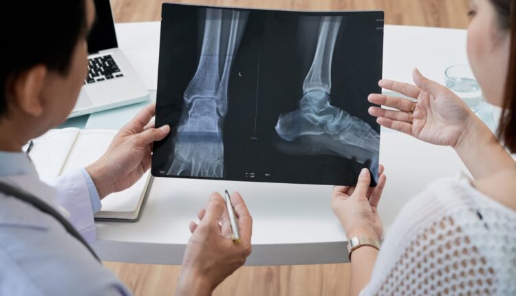 تفاوت پزشک ورزشی و متخصص ارتوپد