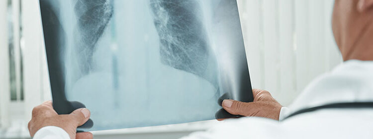 جراحی دیسک کمر