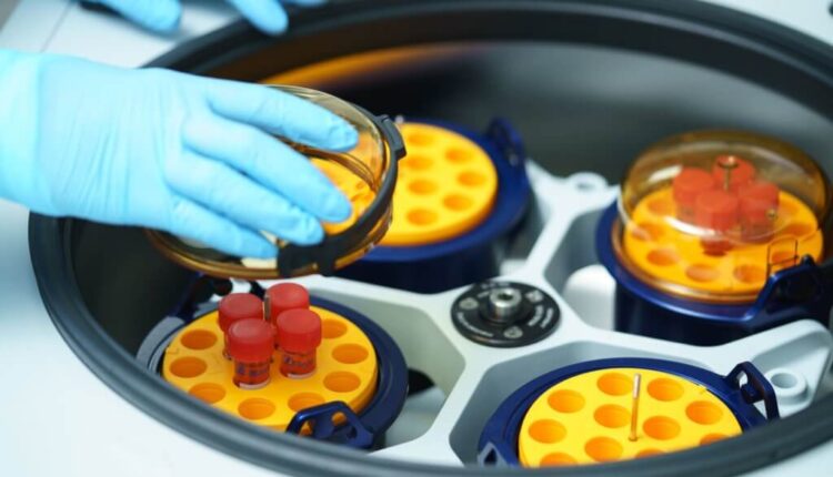 روند درمان تزریق سلول بنیادی