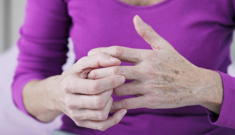 انواع آرتروز