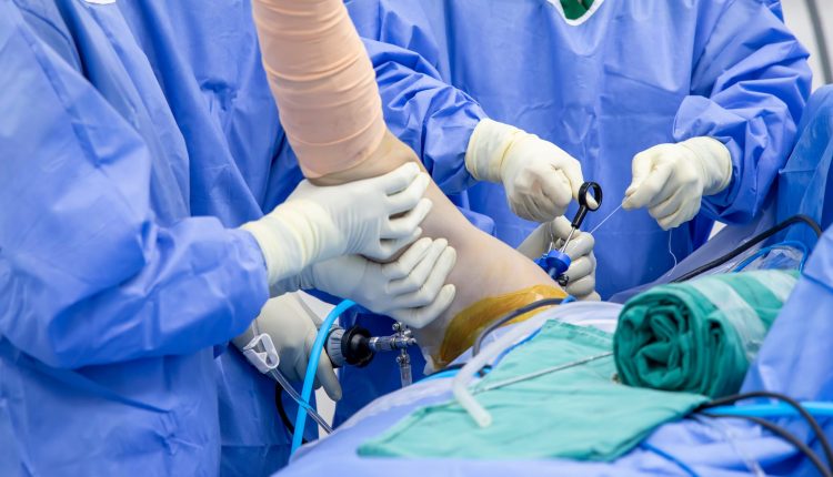 جراحی پارگی تاندون روتارتور کاف