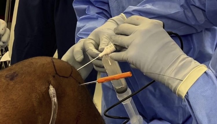 جراحی پارگی رباط صلیبی 