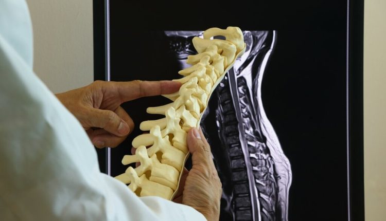 درد ناشی از حرکات تکراری ارتوپد