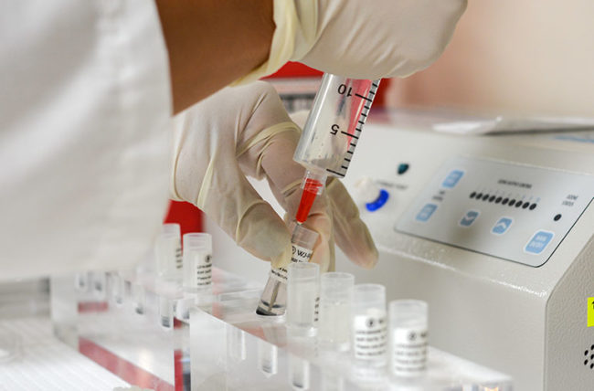 اثر سلولهای بنیادی در تسکین درد و علائم آرتروز