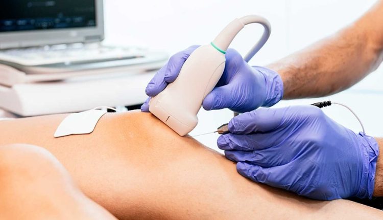 چه زمانی برای ارتروز به پزشک مراجعه کنیم