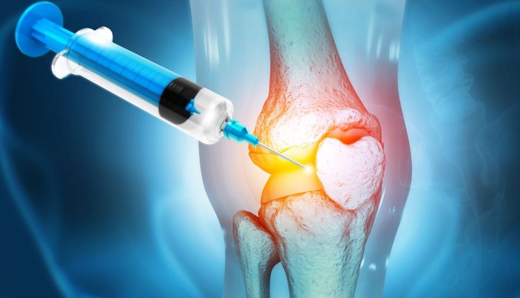 تزریق سلول بنیادی به زانو - درمان مینیسک زانو
