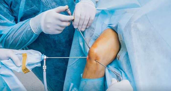 روش درمان آتروز زانو - جراحی آرتروسکپی