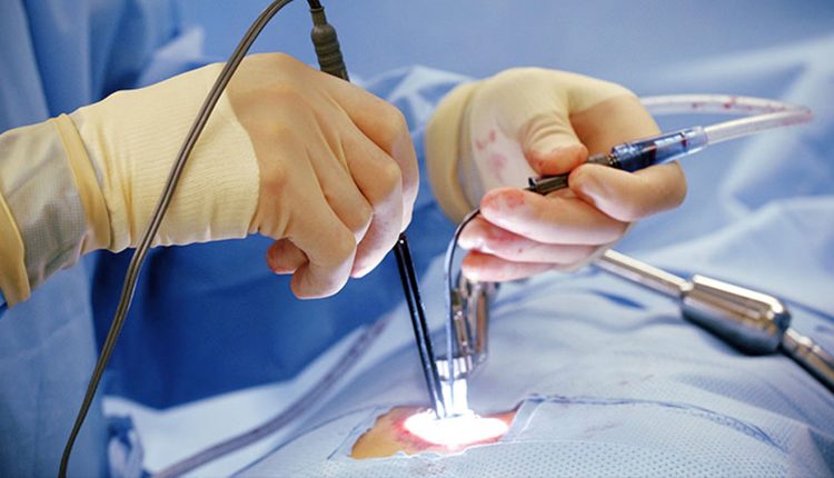 جراحی آرتروز ستون فقرات