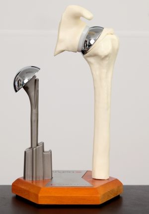 مراحل تعویض مفصل شانه