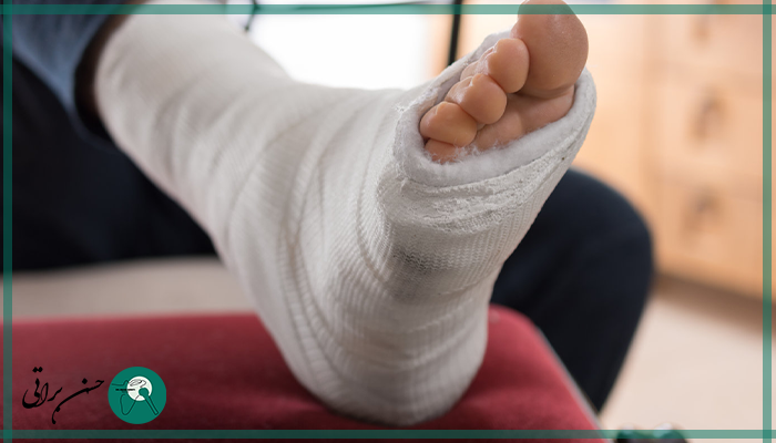 هزینه گچ‌گیری و آتل‌بندی ارتوپدی شامل چه مواردی است؟