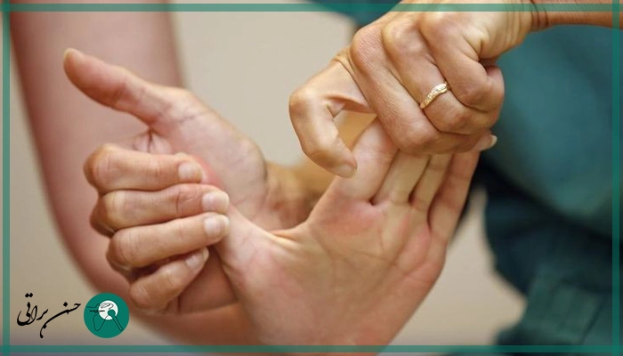 عوامل خطر بعد از عمل تونل کارپال دست