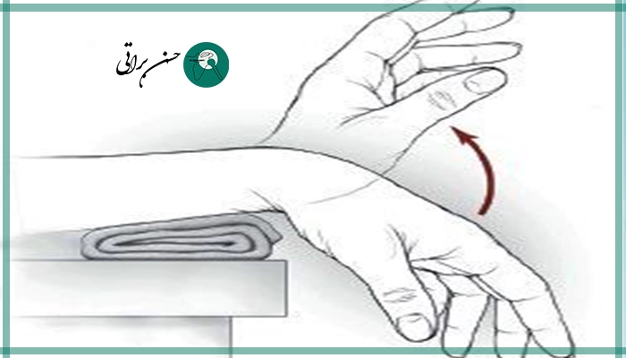 فیزیوتراپی و بازتوانی بعد از عمل تونل مچ دست با خم و صاف کردن دست