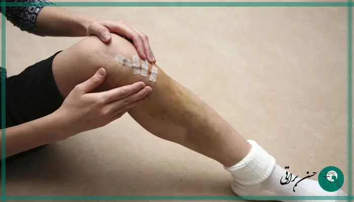 دلیل پارگی مجدد رباط صلیبی