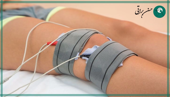 آرتروسکوپی زانو در بیمارستان دولتی و خصوصی