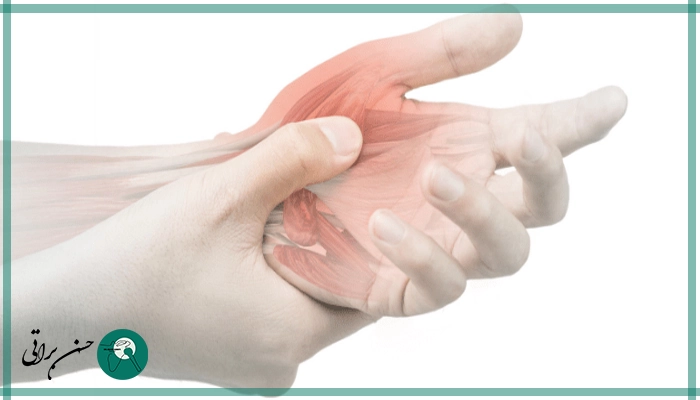 عمل تونل کارپال دست