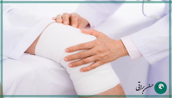 مراقبت بعد آرتروسکوپی زانو