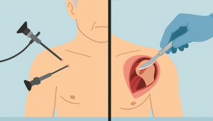 جراحی شانه بسته یا باز؟ مقایسه صفر تا صدی !